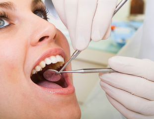 Blas Dental estética dental 