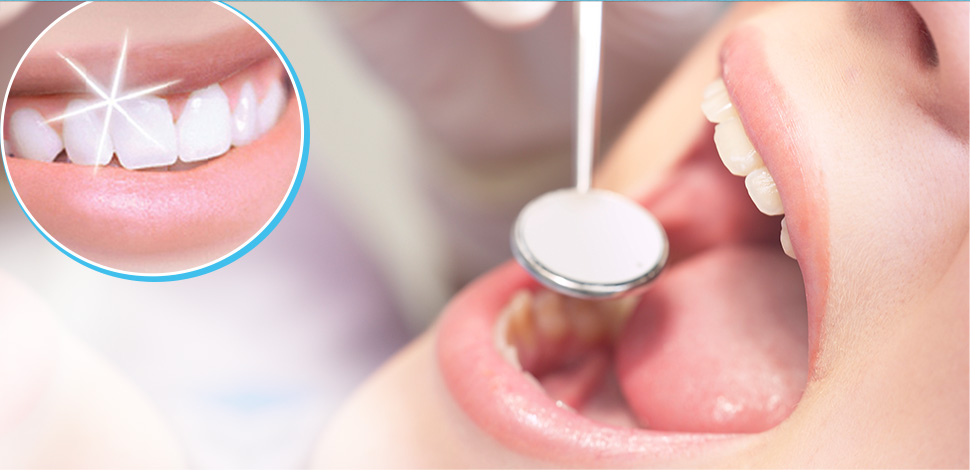 Blas Dental odontología